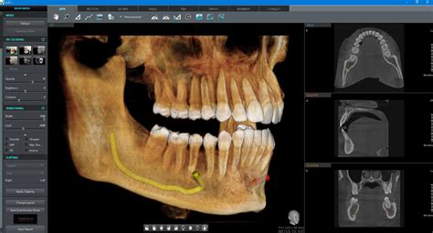 cbct scan dental code.